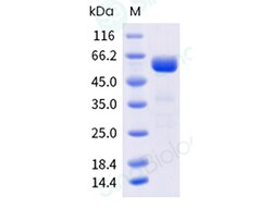Sino Biological Recombinant Human ALPPL2/ALPG Protein (His Tag), HPLC-verified,
