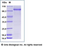 Sino Biological Recombinant Human GARS1 Protein (His Tag), Quantity: Each