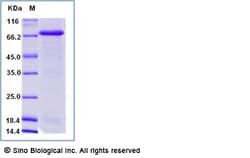 Sino Biological Recombinant Human CD57/B3gat1 Protein (mFc Tag), Quantity: