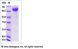 Sino Biological Recombinant Human IL-15 R alpha/IL15RA Protein (ECD, hFc