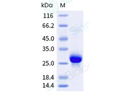 Sino Biological Recombinant Human PHOX2B Protein (His & SUMO Tag), HPLC-verified,