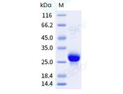 Sino Biological Recombinant Human PHOX2B Protein (His & SUMO Tag), HPLC-verified,