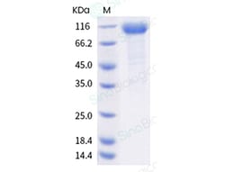 Sino Biological Recombinant Human LILRA1/LIR-6/CD85i Protein (hFc Tag),