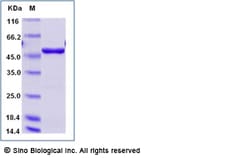 Sino Biological Recombinant Human SSB/Lupus La Protein Protein (His Tag),