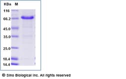 Sino Biological Recombinant Human Exosome Component 9/EXOSC9 Protein (His