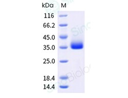 Sino Biological Recombinant Human PRG2 Protein (His Tag), HPLC-verified,