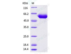 Sino Biological Recombinant Human LAG-3 Protein (ECD, His Tag), HPLC-verified,