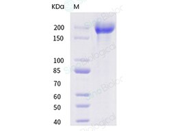 Sino Biological Recombinant Human LY75/CD205 Protein (ECD, His Tag), HPLC-verified,