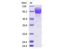 Sino Biological Recombinant Human FGFR1 Protein (alpha (IIIb), His Tag),