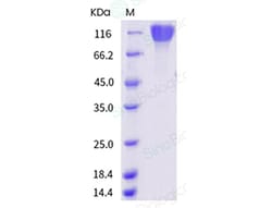 Sino Biological Recombinant Human FGFR1 Protein (alpha (IIIb), hFc Tag),