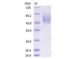 Sino Biological Recombinant Human FGFR1 Protein (beta (IIIb), His Tag),