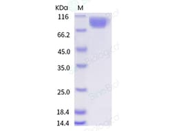 Sino Biological Recombinant Human FGFR1 Protein (beta (IIIb), hFc Tag),