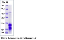 Sino Biological VEGF145 Protein, Human, Recombinant, Quantity: Each of