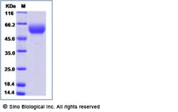 Sino Biological Recombinant Human B7-H7/HHLA2 Protein (His Tag), HPLC-verified,