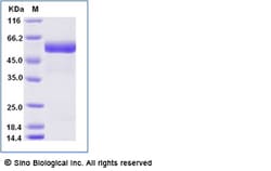 Sino Biological Recombinant Human ROR2 Protein (ECD, His & AVI Tag), Biotinylated,