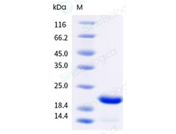 Sino Biological Human GH1 Protein, Quantity: Each of 1