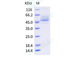 Sino Biological Human CCR2-Nanodisc Protein (Isoform B, His & Flag Tag),