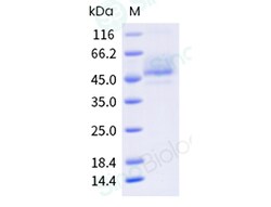 Sino Biological Human CCR2-Nanodisc Protein (Isoform B, His & Flag Tag),