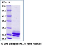 Sino Biological Recombinant Human GITR Ligand/TNFSF18 Protein (His Tag),