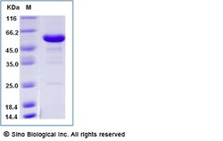 Sino Biological Recombinant Human RANK/TNFRSF11A Protein (ECD, mFc Tag),