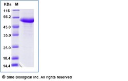 Sino Biological Recombinant Human RYK Protein (ECD, hFc Tag), Quantity: