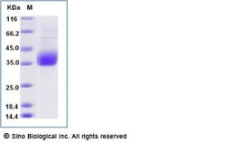 Sino Biological Recombinant Human ILT11/LILRA5/LIR-9 Protein (ECD, His