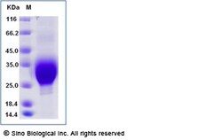 Sino Biological Recombinant Human CD300f/LMIR3 Protein (His Tag), HPLC-verified,