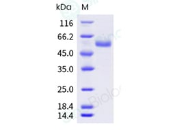 Sino Biological Recombinant Human CD39/ENTPD1 Protein (ECD, His Tag), HPLC-verified,