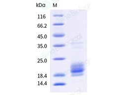 Sino Biological Recombinant Human IL-5 Protein, Quantity: Each of 1