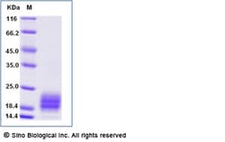 Sino Biological Recombinant Human IL-5 Protein (His Tag), Quantity: Each