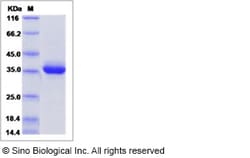 Sino Biological Recombinant Human beta Defensin 1/DEFB1 Protein (hFc Tag),
