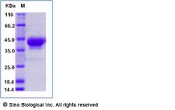 Sino Biological Recombinant Human CD52 Protein (hFc & AVI Tag), Biotinylated,