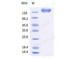 Sino Biological Recombinant Human CD45 Protein (ECD, His & AVI Tag), Biotinylated,