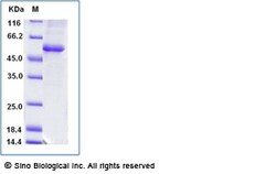 Sino Biological Recombinant Human DLST Protein (His Tag), Quantity: Each