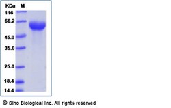 Sino Biological Recombinant Human ROR1 Protein, Amine-Labeled Biotinylated,