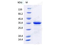 Sino Biological Recombinant Human SOX2 Protein (His Tag), Quantity: Each