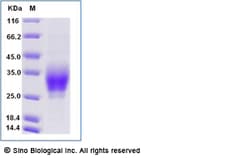 Sino Biological Recombinant Human CD28H/IGPR-1/TMIGD2 Protein (ECD, His