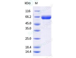 Sino Biological Recombinant Human PILR-alpha/FDF03 Protein (hFc & AVI Tag),