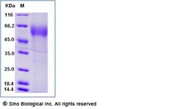 Sino Biological Recombinant Human AMIGO2 Protein (His Tag), Amine-Labeled