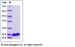 Sino Biological Recombinant Human TFF1/Trefoil Factor 1 Protein (His Tag),