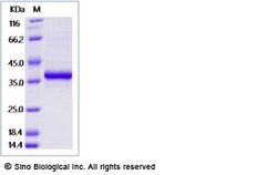 Sino Biological Recombinant Human FGL1 Protein (His & AVI Tag), Quantity: