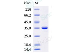 Sino Biological Recombinant Human FGL1 Protein (His Tag), HPLC-verified,