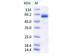 Sino Biological Recombinant Human FGL1 Protein (hFc Tag), Quantity: Each