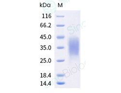 Sino Biological Recombinant Human VISTA/B7-H5 Protein (His Tag), HPLC-verified,
