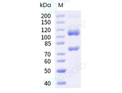 Sino Biological C5 Protein, Human, Recombinant (His & FLAG Tag), Quantity: