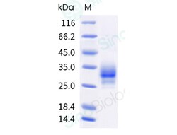 Sino Biological Recombinant Human LAIR1 Protein (ECD, His & AVI Tag), Biotinylated,