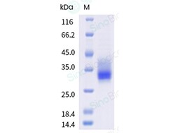Sino Biological Recombinant Human FGF-18 Protein (His Tag), Quantity: Each