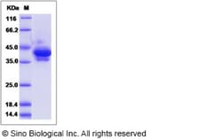 Sino Biological Recombinant Human Parathyroid Hormone/PTH Protein (hFc