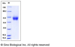 Sino Biological Recombinant Human Tissue Factor Protein (His Tag), HPLC-verified,