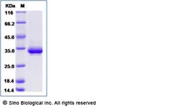 Sino Biological Recombinant Human Mesothelin Protein (His Tag), Amine-Labeled